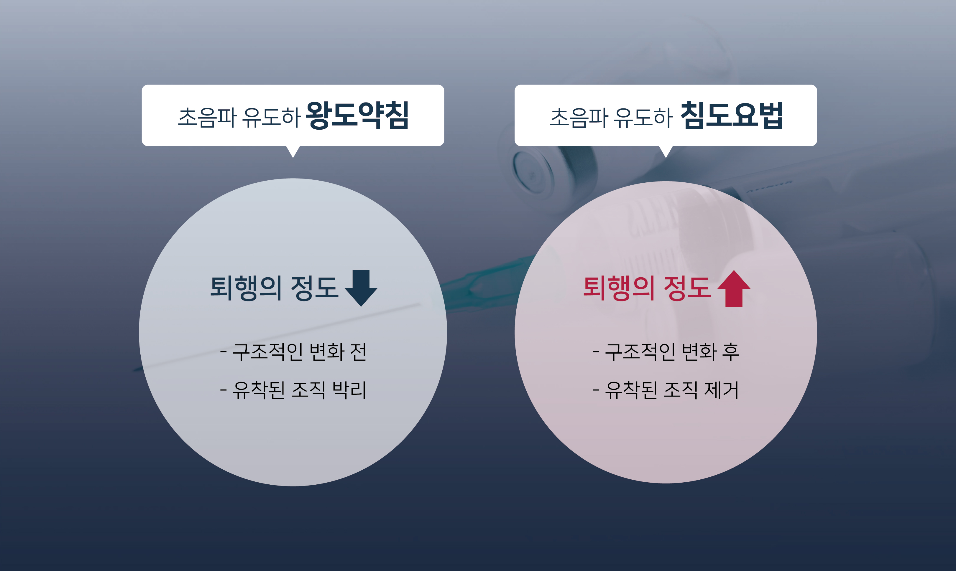 침도요법